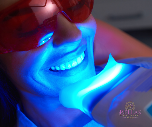 Teeth Whitening